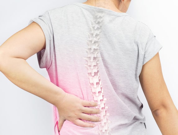 spondylosis treatment